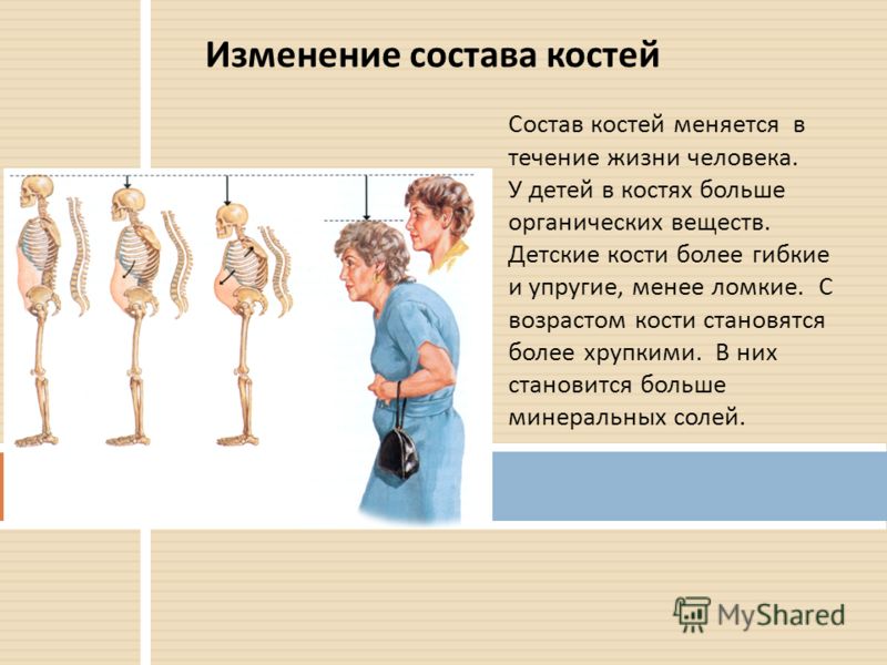 С возрастом человек становится. Возрастные изменения химического состава костей человека. Изменение костей. Изменение костей с возрастом человека. Возрастные изменения костной системы человека.