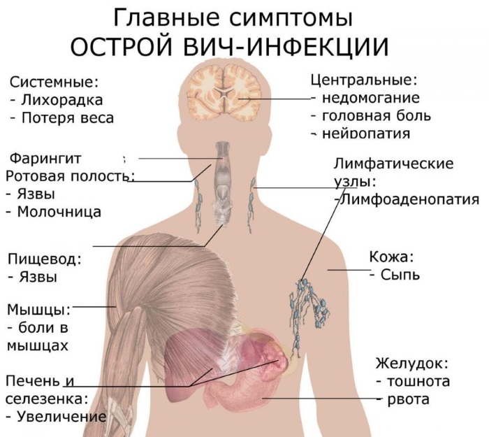 СПИД. Как передается от человека к человеку, симптомы, признаки, лечение