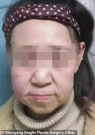 Xiao Feng (pictured), a 15-year-old from rural China, suffers from a rare genetic condition that makes her appear decades older