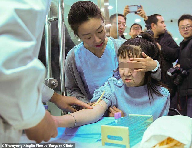 Medics has claimed that Xiao Feng suffers from progeria. The teen is now going through pre-surgical checks, and her operation has been scheduled to take place at the end of the month