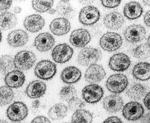 Human Immunodeficency Virus - stylized rendering.jpg